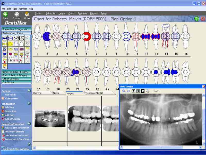 DentiMax Dental Practice Management 06.01