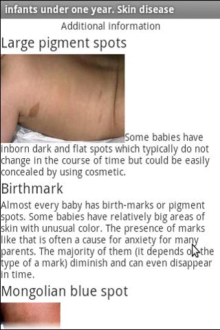 Disease skin in infants Varies with device