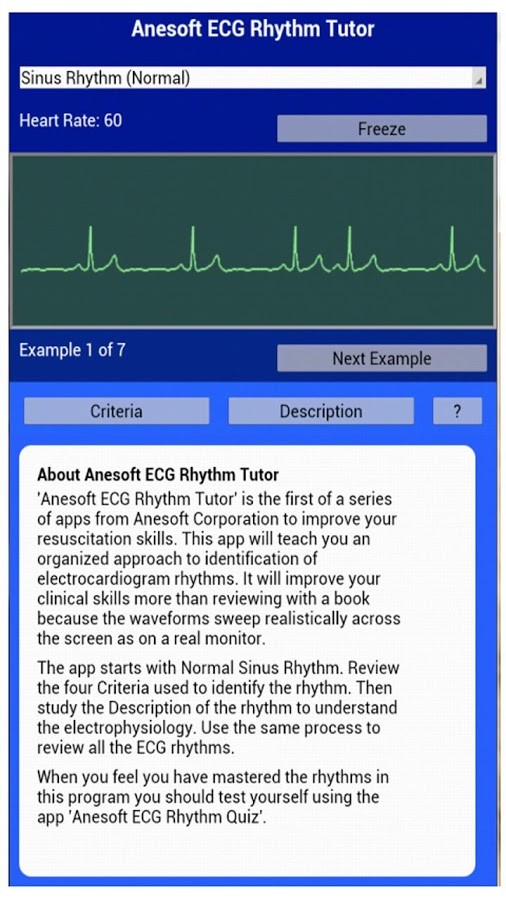 ECG Rhythm Tutor 1.2