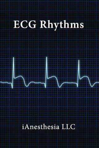 ECG Rhythms (The EKG Guide) 1.3