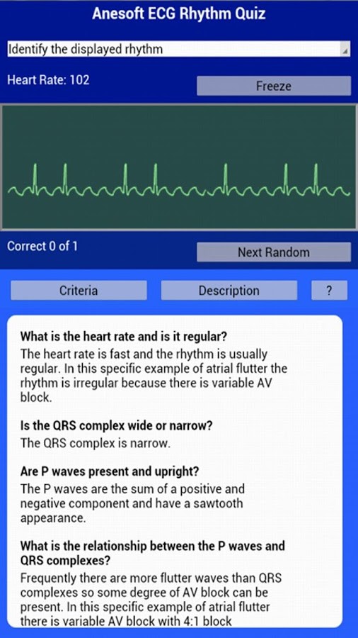 ECG Rhythms Quiz 1.2